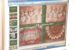 症例を見ながらカウンセリング